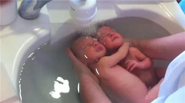 新生雙胞胎緊緊抱在一起洗澡 以為還在媽媽肚子里…