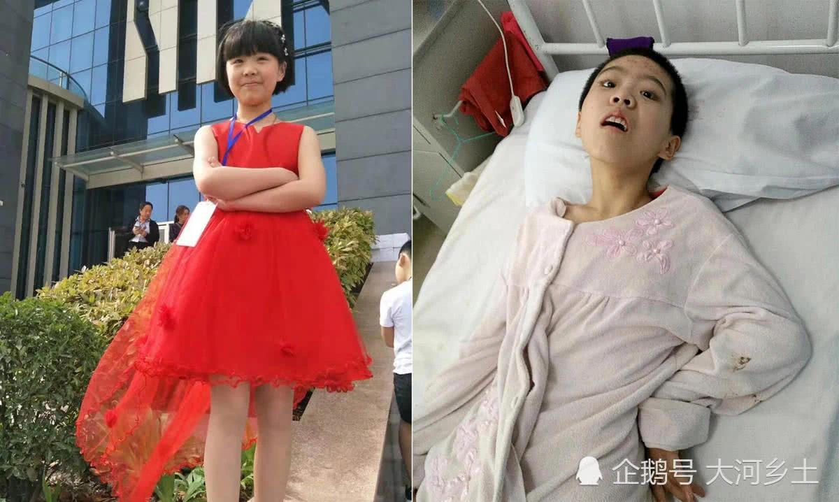 女孩误喝妈妈一杯茶 住院花费30万