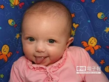 女儿刚出生就“猛吐舌头” 超可爱!如今爸妈崩溃痛哭:因为舌头她快要死掉了!