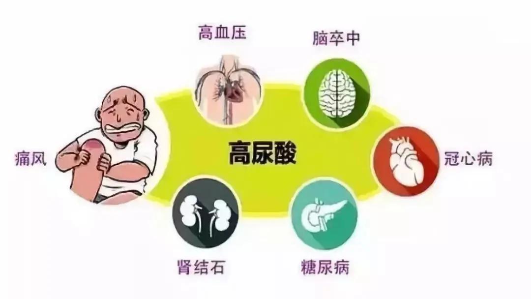 尿酸高多半是吃出来的!这些东西一定要忌口