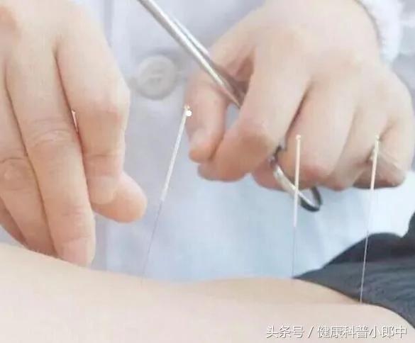 这3个民间小偏方 教你快速远离湿疹 用过的都说好!