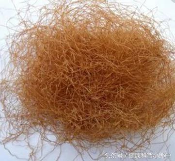这3个民间小偏方 教你快速远离湿疹 用过的都说好!