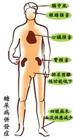 警钟长鸣糖尿病并发症、血糖标准、健康饮食运动