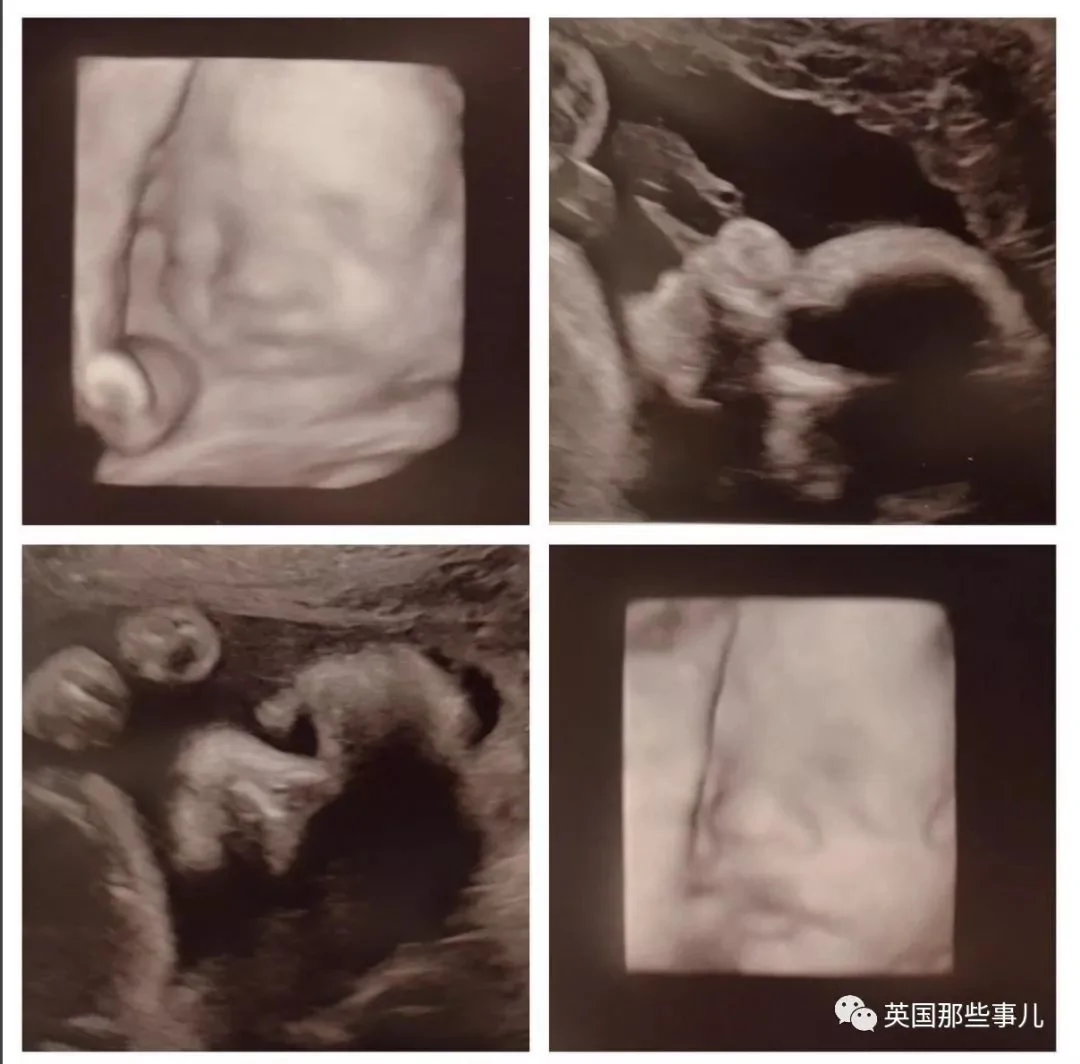 小两口装修凿墙发现可爱的惊喜 万万没想到!