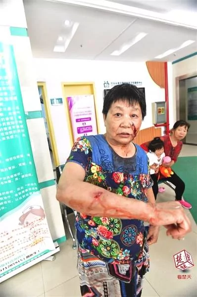 大狗扑来 从女子怀里叼走半岁宝宝 一顿乱咬… !