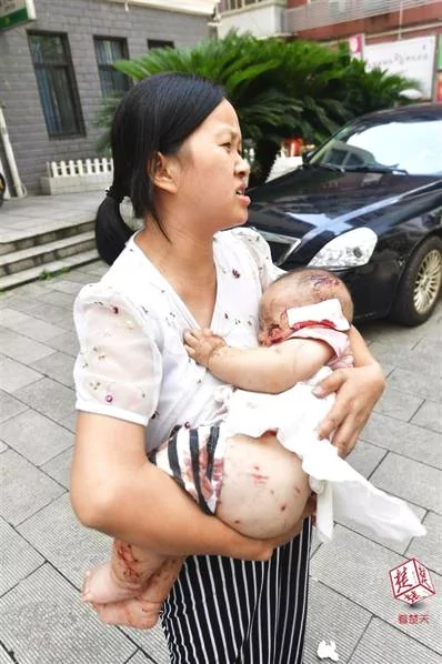 大狗扑来 从女子怀里叼走半岁宝宝 一顿乱咬… !