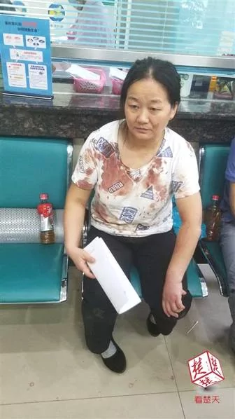 大狗扑来 从女子怀里叼走半岁宝宝 一顿乱咬… !