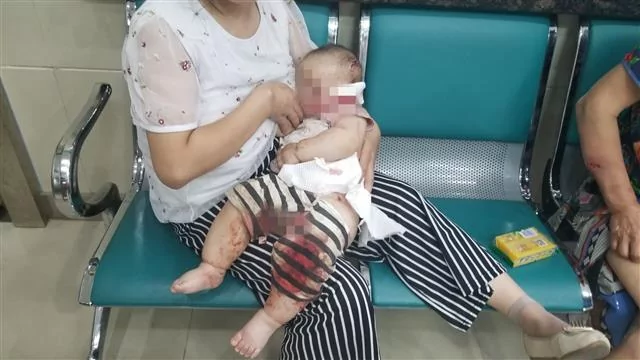 大狗扑来 从女子怀里叼走半岁宝宝 一顿乱咬… !