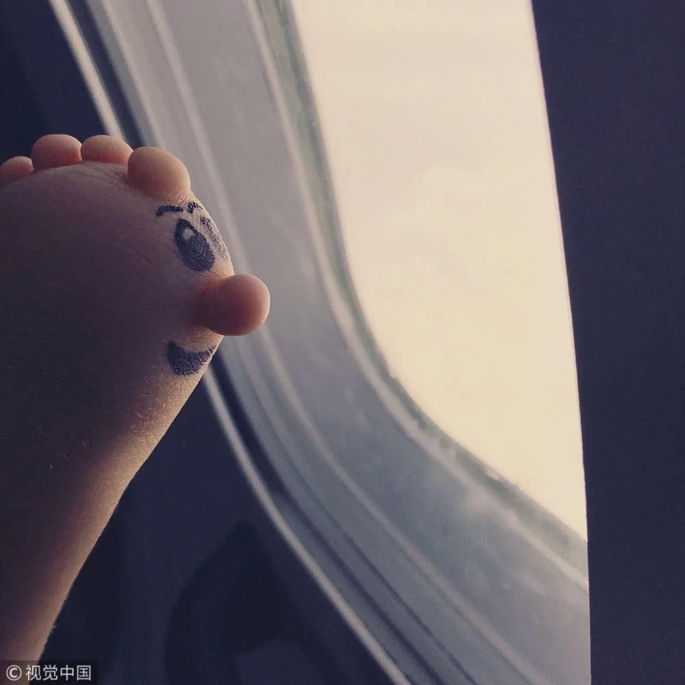 美女孩左臂畸形仍“恶搞” 将缺憾变可爱