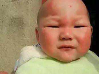 蚊子为什么总是绕开“娘” 而去攻击“娃”!
