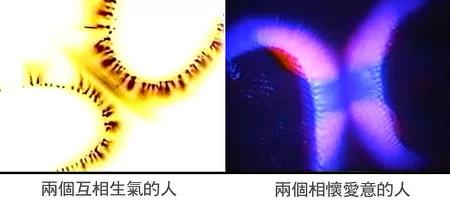 为什么绝症有时可以不医而愈?