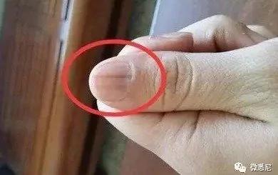 澳洲女子突然晒了张特写照 救了很多人