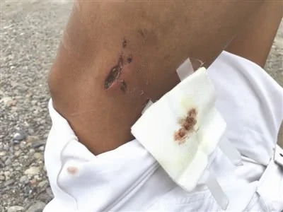 小伙被恶犬追咬跳江:浑身流血 呼救50分钟!