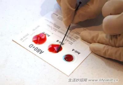 这15个生理征兆 对你的健康提出了警告!