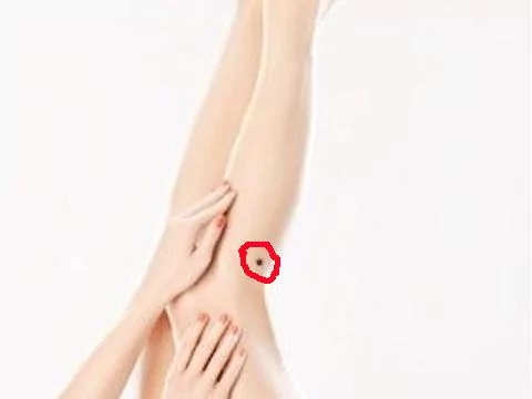 最常见的9大幸运痣!你有吗?