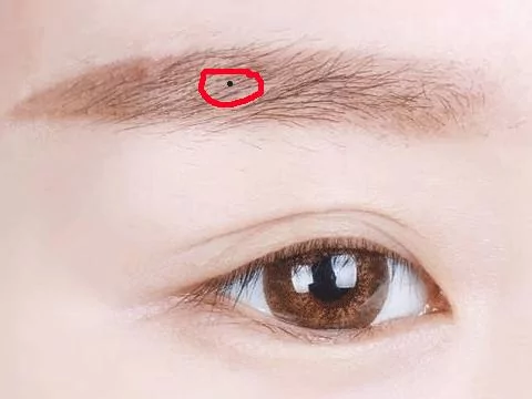最常见的9大幸运痣!你有吗?