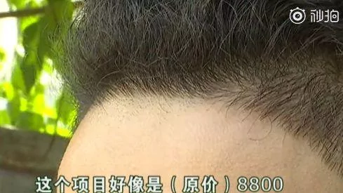 发际线男孩火了 今年的笑点都被你承包
