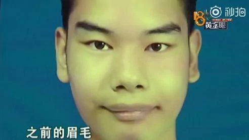 发际线男孩火了 今年的笑点都被你承包