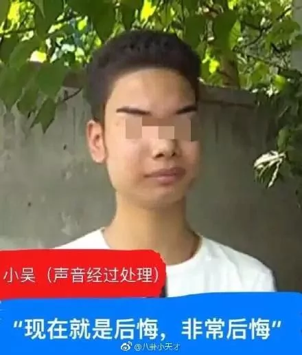 发际线男孩火了 今年的笑点都被你承包