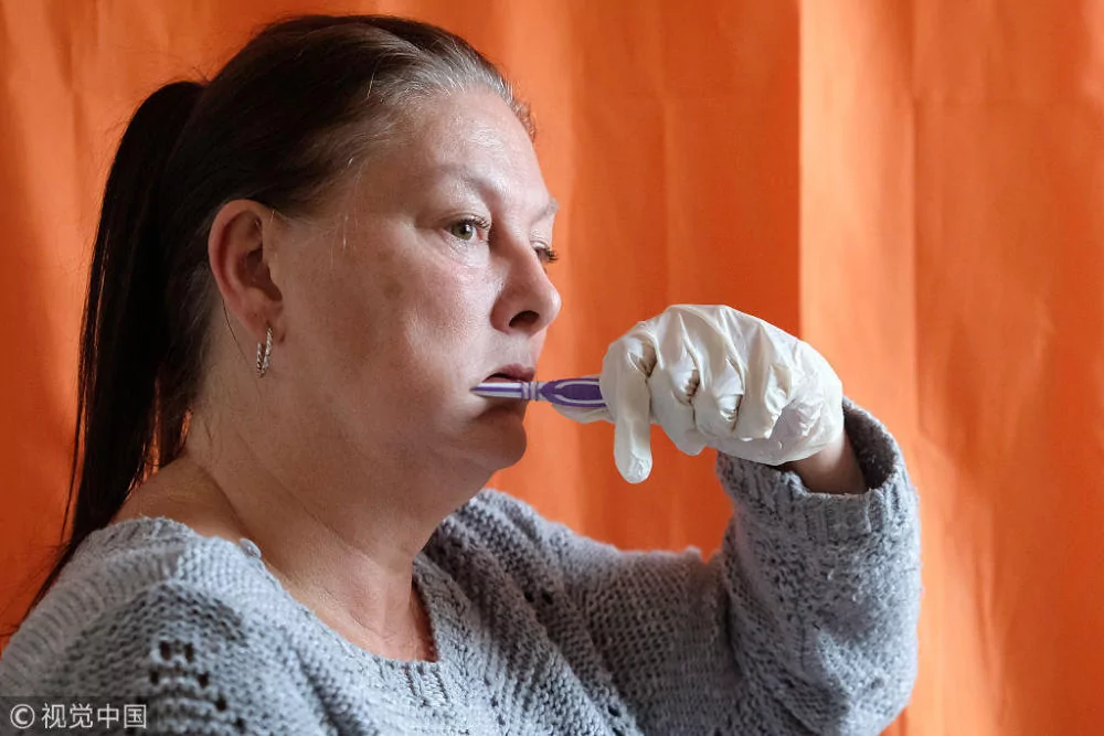 英国女子患罕见水过敏症 生活痛苦如坐牢!