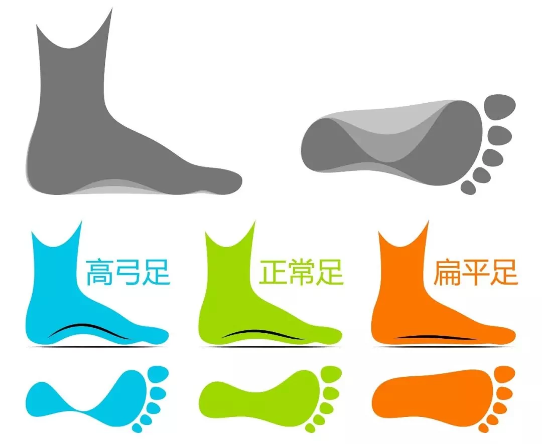 鞋底磨的偏左偏右 竟是疾病信号!快看你偏哪一边!