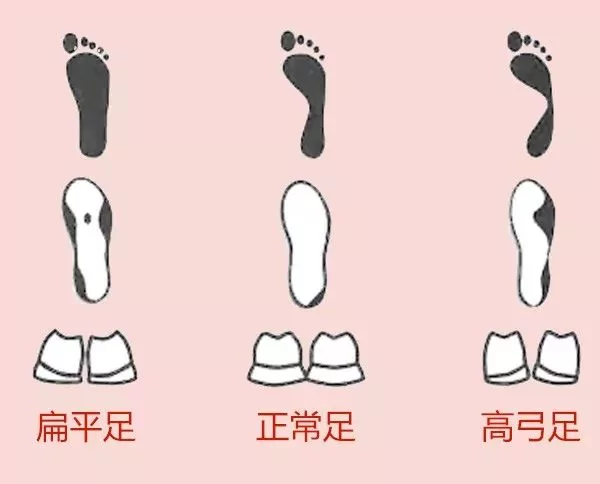 鞋底磨的偏左偏右 竟是疾病信号!快看你偏哪一边!