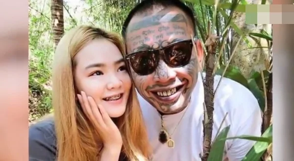 女子砸百万要整成杨幂 肿的成这样
