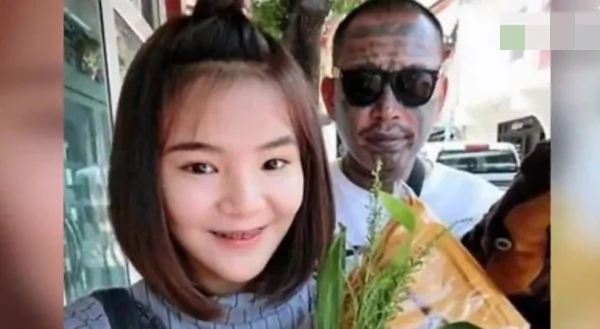 女子砸百万要整成杨幂 肿的成这样