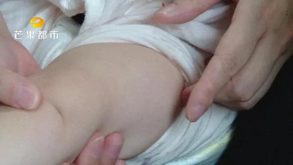 湖南郴州 存有活病毒的口服疫苗被打进孩子体内