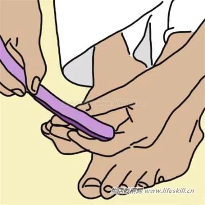 脚趾甲嵌进肉里了咋办?教你10个方法来解决