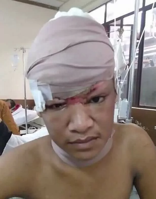 女孩坐摩天轮睡着头发被缠住 醒来被扯成秃子!