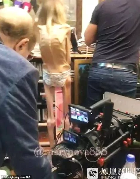 俄罗斯女子厌食瘦成34斤 医生称可演活尸!