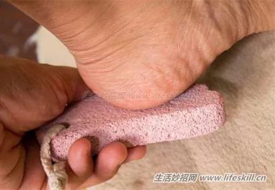 教你3招 轻松摆脱脚臭的困扰!