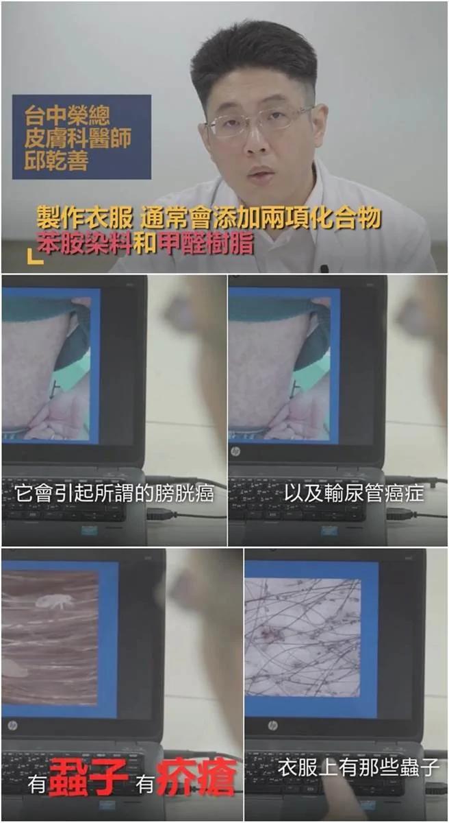 习惯新衣不洗就穿?医:小心2化学物恐致癌+虫上身