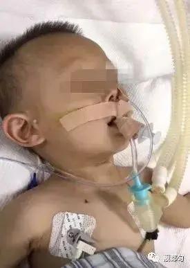这才是幼儿死亡“第一大杀手”!儿科医师痛心疾首:千万别对孩子做这些事儿!