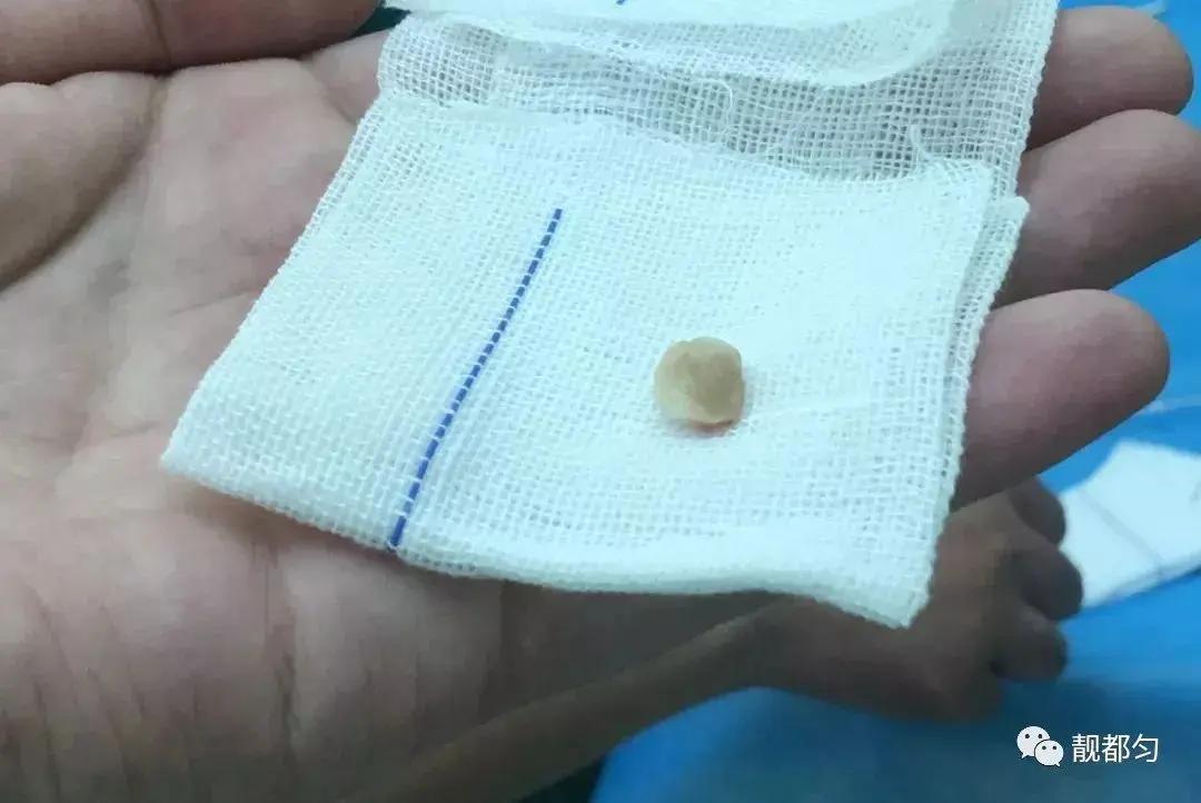 这才是幼儿死亡“第一大杀手”!儿科医师痛心疾首:千万别对孩子做这些事儿!