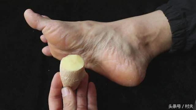 生姜抹在脚上太厉害 学会了家家户户都需要