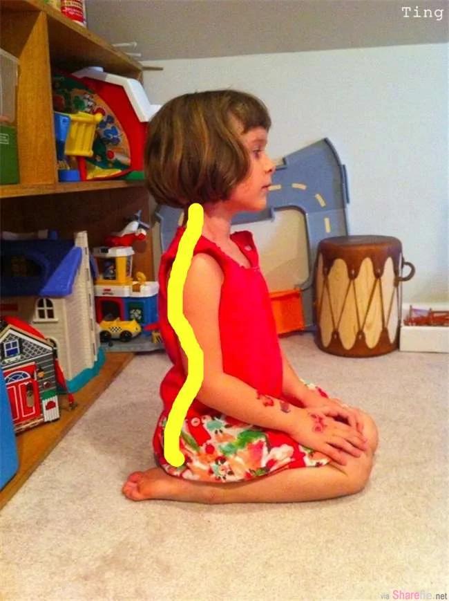 专家警告!孩子们这个看似平常的“坐姿” 居然会导致嵴椎前凸 更让孩子发育迟缓!