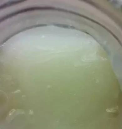 家里有芦荟的注意了 可别不当回事 越早知道越好!