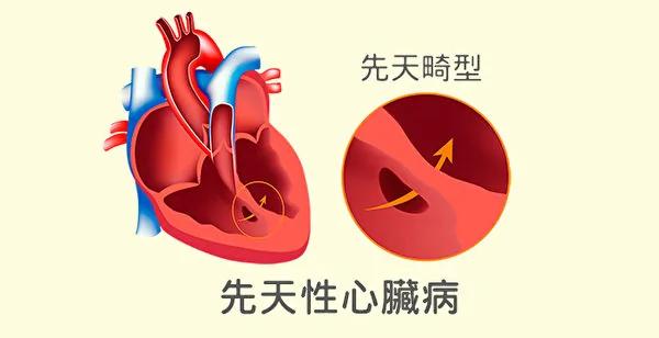 为什么会得心脏病?常见的心脏病和防治方法