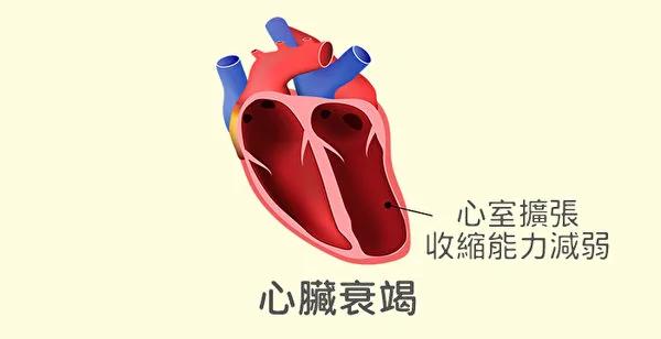 为什么会得心脏病?常见的心脏病和防治方法