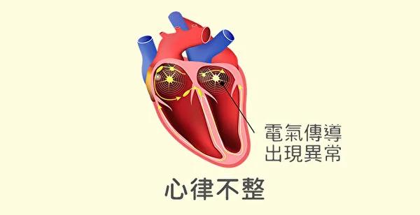 为什么会得心脏病?常见的心脏病和防治方法