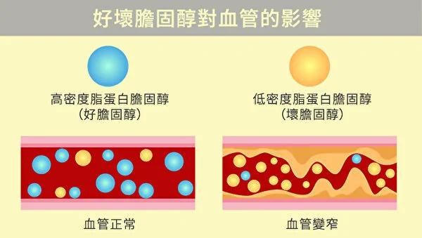 降坏胆固醇 增好胆固醇 你该吃这些食物