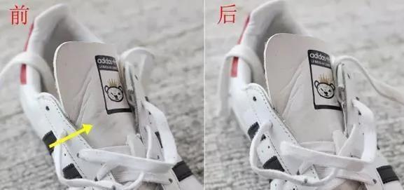 天呐!小白鞋居然这样洗就变成新的了!真后悔以前都直接扔!