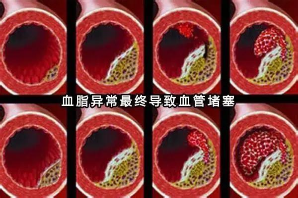太全了!“三高”人群哪些能吃 哪些不能吃?40岁后人手一份!