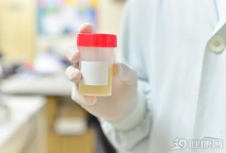 小便有一层泡沫 是得肾病吗?还有几个“冷门”原因