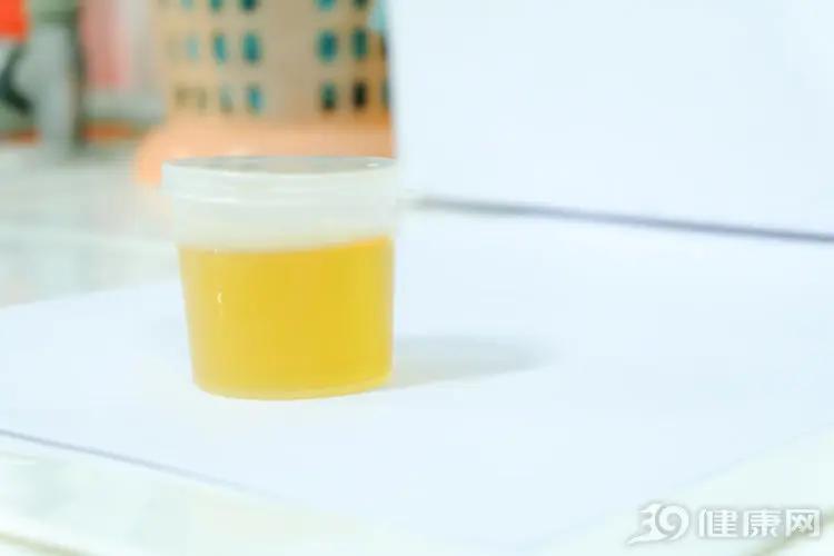 小便有一层泡沫 是得肾病吗?还有几个“冷门”原因