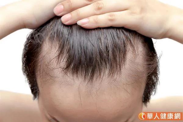 藏在头发里的健康密码 白发、稀疏、出油 这些头皮问题这样解