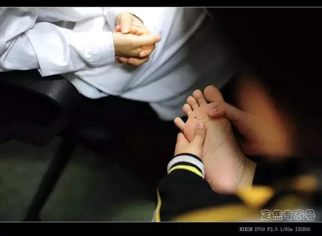 这些癌变都是手欠惹的祸!医生:身体这些部位长"痣"千万别抠!