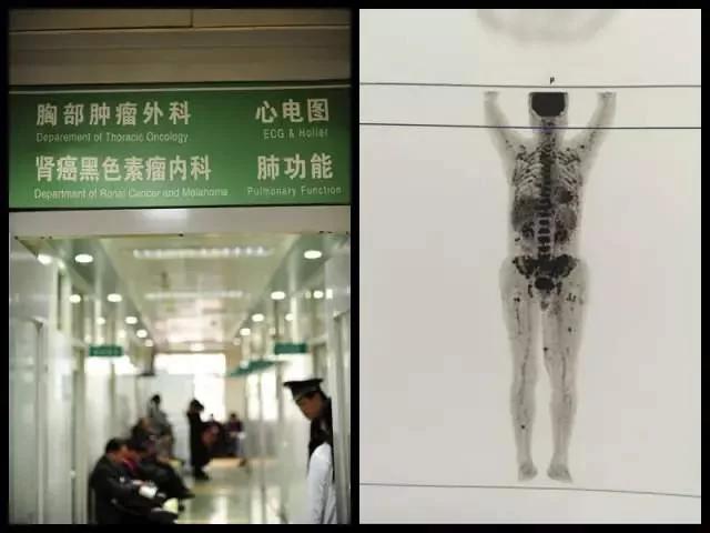 这些癌变都是手欠惹的祸!医生:身体这些部位长"痣"千万别抠!